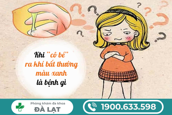 Hình ảnh minh họa